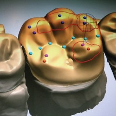 Digital Dental Lab Technology: For The Techie Kid Inside Us All